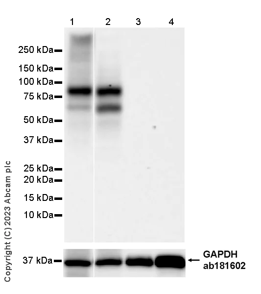 Western blot - Anti-OATP1B1 antibody [EPR27070-49] (AB312838)