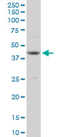 Western blot - Anti-OBFC1 antibody (AB89250)
