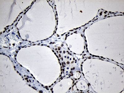 Immunohistochemistry (Formalin/PFA-fixed paraffin-embedded sections) - Anti-OBFC2A antibody [OTI6B10] (AB236402)