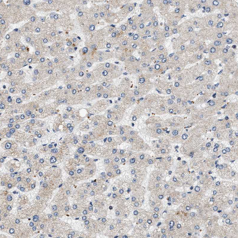 Immunohistochemistry (Formalin/PFA-fixed paraffin-embedded sections) - Anti-OBSCN antibody (AB121652), expandable thumbnail