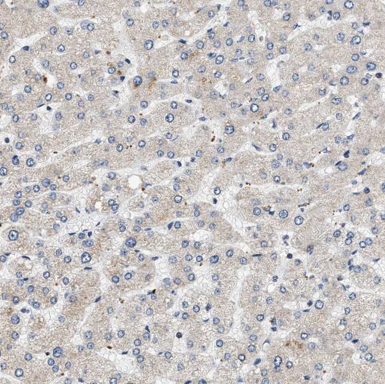 Immunohistochemistry (Formalin/PFA-fixed paraffin-embedded sections) - Anti-OBSCN antibody (AB121652)