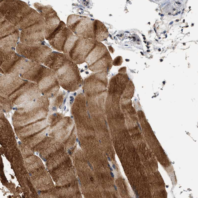 Immunohistochemistry (Formalin/PFA-fixed paraffin-embedded sections) - Anti-OBSCN antibody (AB121652), expandable thumbnail