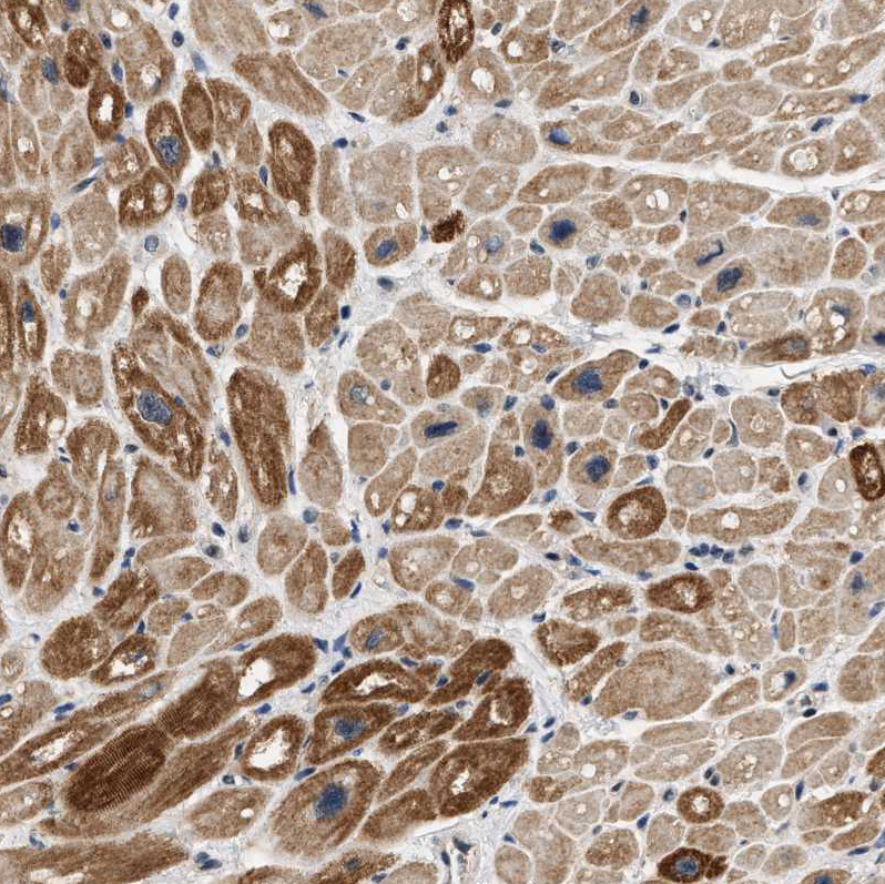 Immunohistochemistry (Formalin/PFA-fixed paraffin-embedded sections) - Anti-OBSCN antibody (AB121652), expandable thumbnail