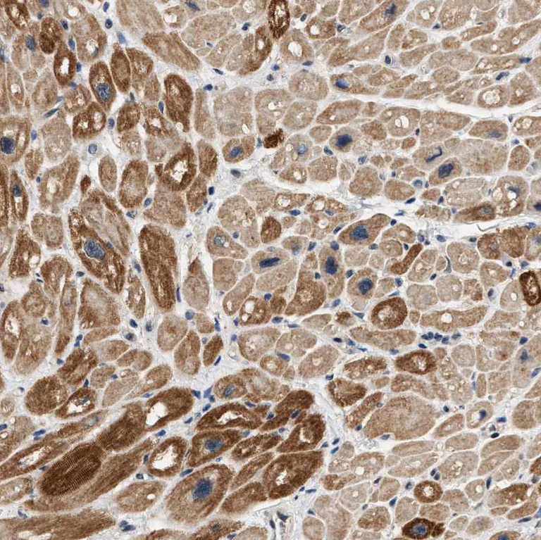 Immunohistochemistry (Formalin/PFA-fixed paraffin-embedded sections) - Anti-OBSCN antibody (AB121652)