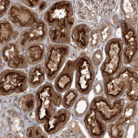 Immunohistochemistry (Formalin/PFA-fixed paraffin-embedded sections) - Anti-OBSL1 antibody (AB204075)