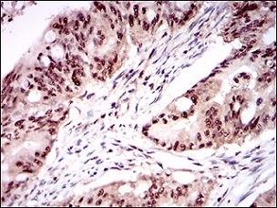 Immunohistochemistry (Formalin/PFA-fixed paraffin-embedded sections) - Anti-OC-3 antibody [10B2F5] (AB181450), expandable thumbnail
