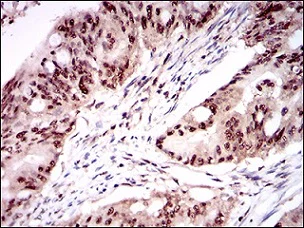 Immunohistochemistry (Formalin/PFA-fixed paraffin-embedded sections) - Anti-OC-3 antibody [10B2F5] (AB181450)