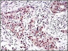 Immunohistochemistry (Formalin/PFA-fixed paraffin-embedded sections) - Anti-OC-3 antibody [10B2F5] (AB181450), expandable thumbnail