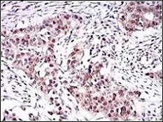 Immunohistochemistry (Formalin/PFA-fixed paraffin-embedded sections) - Anti-OC-3 antibody [10B2F5] (AB181450)