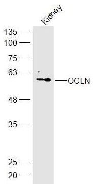 Western blot - Anti-Occludin antibody (AB222691)