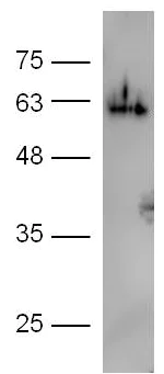 Western blot - Anti-Occludin antibody (AB222691)