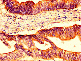 Immunohistochemistry (Formalin/PFA-fixed paraffin-embedded sections) - Anti-Occludin antibody (AB235986)