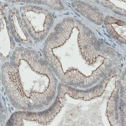Immunohistochemistry (Formalin/PFA-fixed paraffin-embedded sections) - Anti-Occludin antibody [CL1555] (AB242202)