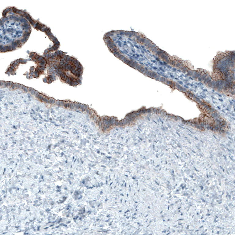 Immunohistochemistry (Formalin/PFA-fixed paraffin-embedded sections) - Anti-Occludin antibody [CL1555] (AB242202)