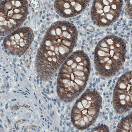 Immunohistochemistry (Formalin/PFA-fixed paraffin-embedded sections) - Anti-Occludin antibody [CL1555] (AB242202)