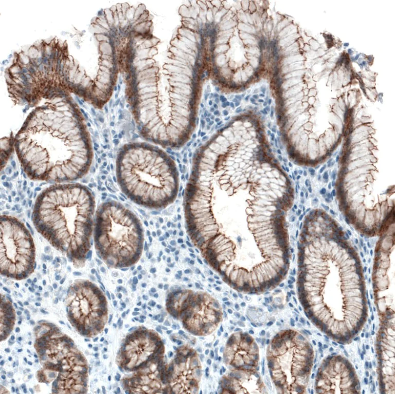 Immunohistochemistry (Formalin/PFA-fixed paraffin-embedded sections) - Anti-Occludin antibody [CL1555] (AB242202)
