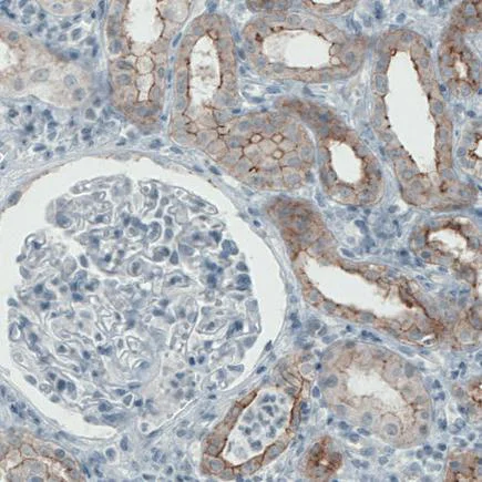 Immunohistochemistry (Formalin/PFA-fixed paraffin-embedded sections) - Anti-Occludin antibody [CL1555] (AB242202)