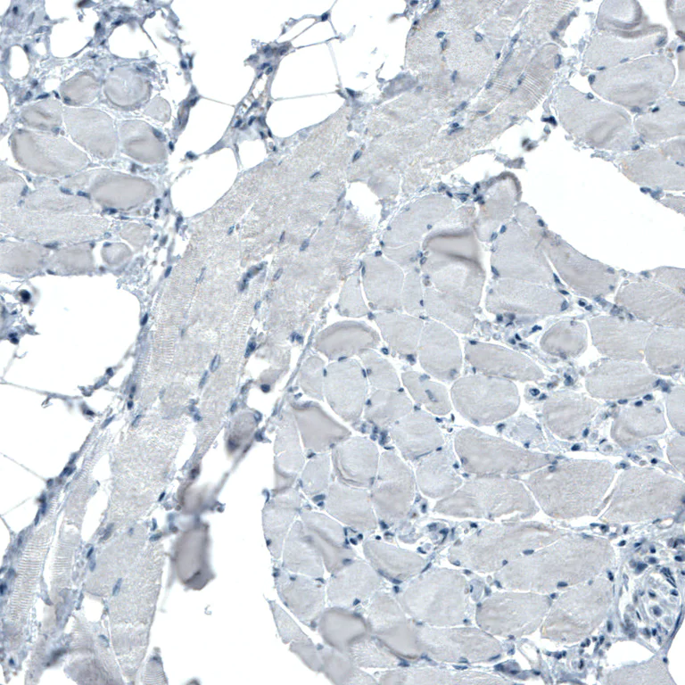 Immunohistochemistry (Formalin/PFA-fixed paraffin-embedded sections) - Anti-Occludin antibody [CL1555] (AB242202)