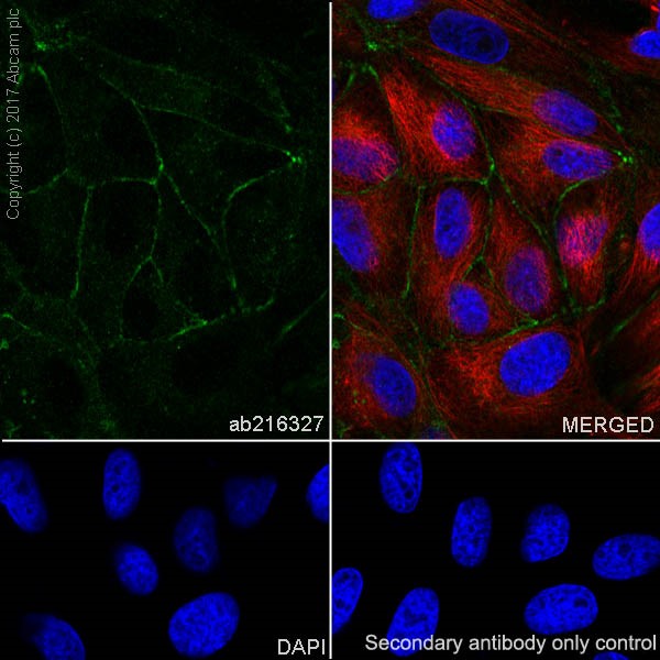 Immunocytochemistry/ Immunofluorescence - Anti-Occludin antibody [EPR20992] (ab216327), expandable thumbnail
