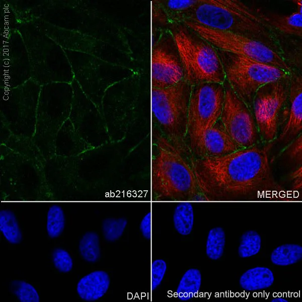 Immunocytochemistry/ Immunofluorescence - Anti-Occludin antibody [EPR20992] (AB216327)