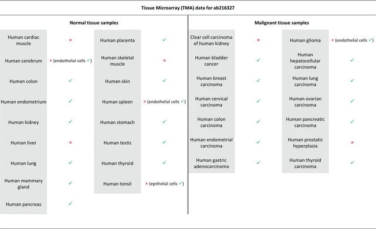 Immunohistochemistry (Formalin/PFA-fixed paraffin-embedded sections) - Anti-Occludin antibody [EPR20992] (AB216327)