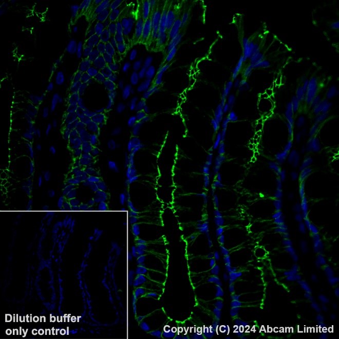 Immunohistochemistry (Formalin/PFA-fixed paraffin-embedded sections) - Anti-Occludin antibody [EPR20992] (ab216327), expandable thumbnail