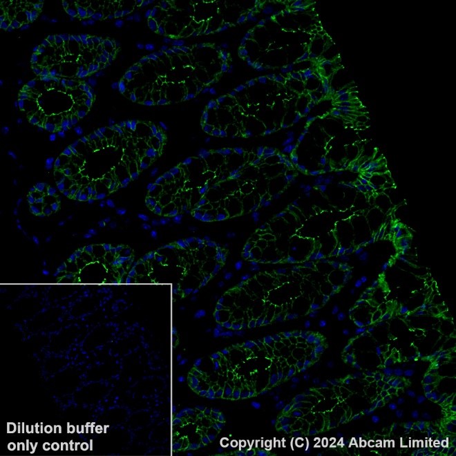 Immunohistochemistry (Formalin/PFA-fixed paraffin-embedded sections) - Anti-Occludin antibody [EPR20992] (ab216327), expandable thumbnail