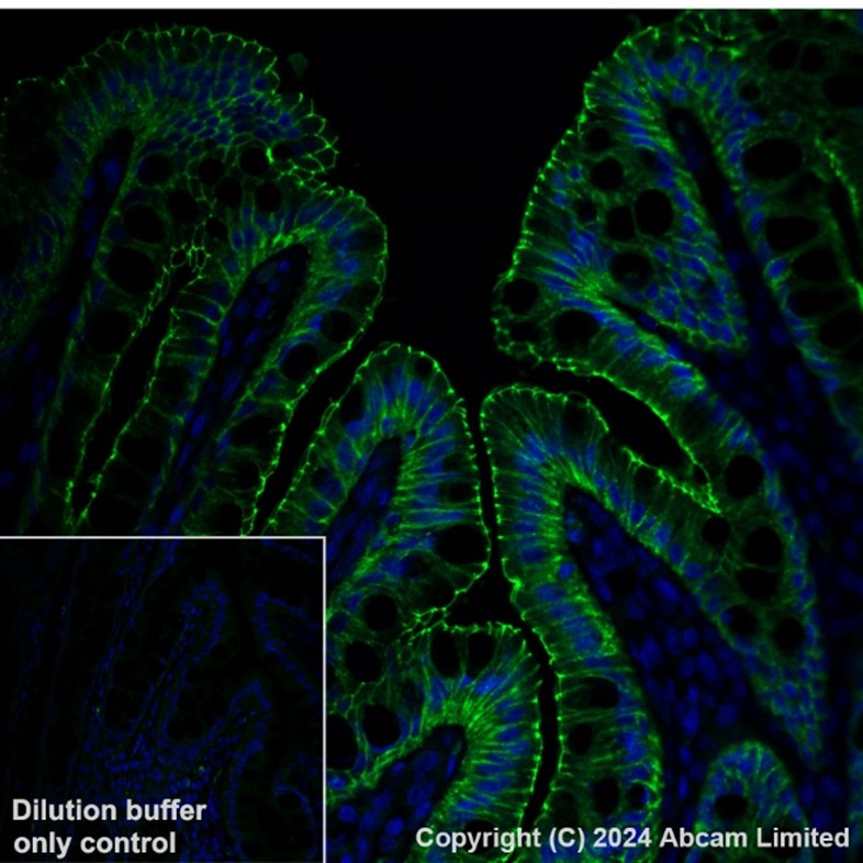 Immunohistochemistry (Formalin/PFA-fixed paraffin-embedded sections) - Anti-Occludin antibody [EPR20992] (ab216327), expandable thumbnail