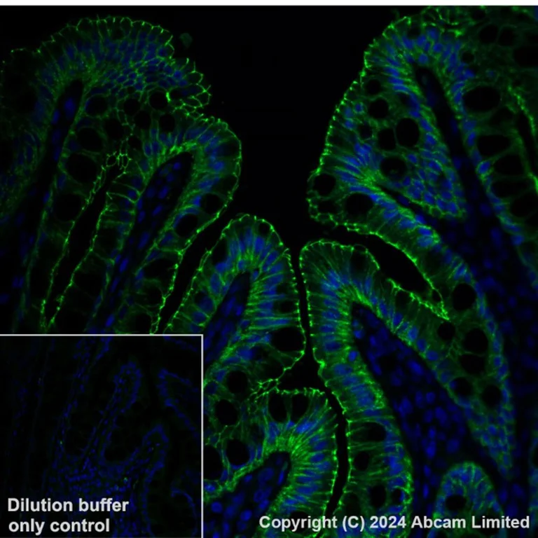 Immunohistochemistry (Formalin/PFA-fixed paraffin-embedded sections) - Anti-Occludin antibody [EPR20992] (AB216327)