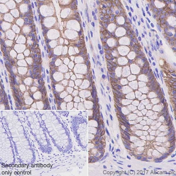 Immunohistochemistry (Formalin/PFA-fixed paraffin-embedded sections) - Anti-Occludin antibody [EPR20992] (AB216327), expandable thumbnail
