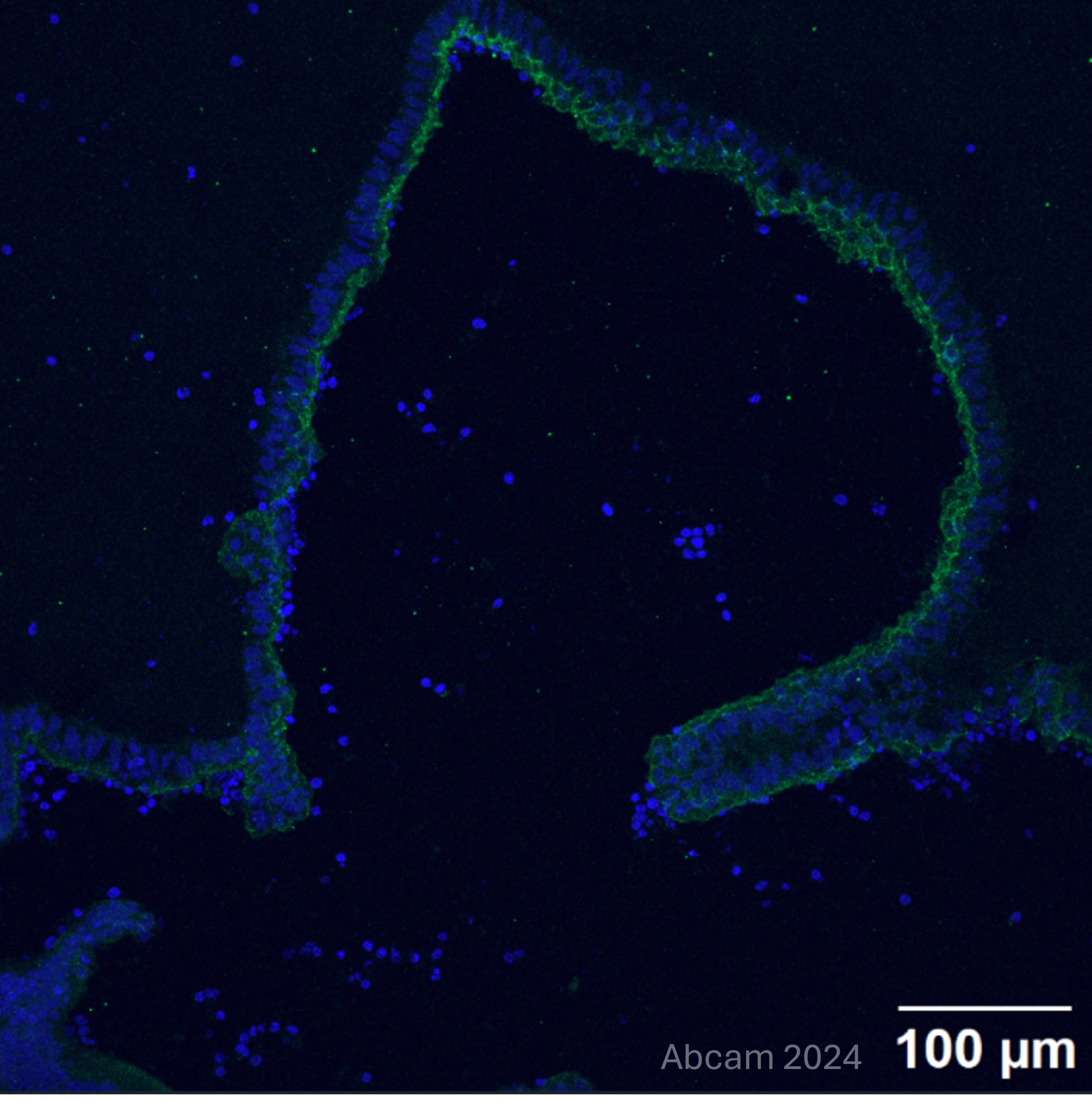 Immunohistochemistry (Frozen sections) - Anti-Occludin antibody [EPR20992] (ab216327), expandable thumbnail