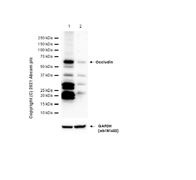 Western blot - Anti-Occludin antibody [EPR20992] (AB216327), expandable thumbnail