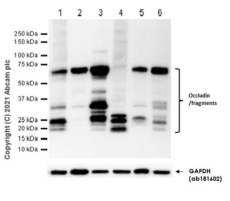 Western blot - Anti-Occludin antibody [EPR20992] (AB216327), expandable thumbnail