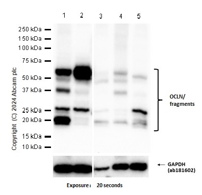 Western blot - Anti-Occludin antibody [EPR20992] (ab216327), expandable thumbnail