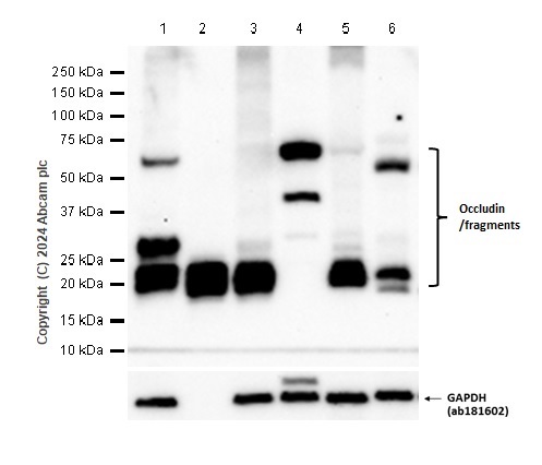 Western blot - Anti-Occludin antibody [EPR20992] (ab216327), expandable thumbnail