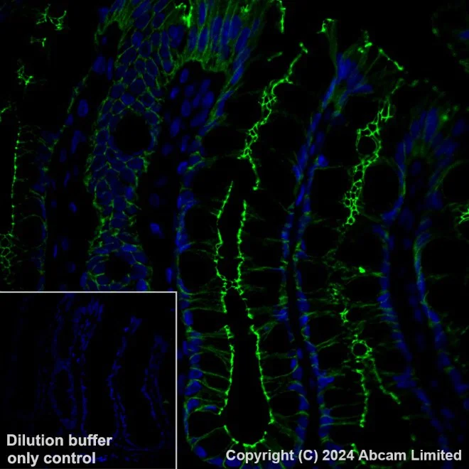 Immunohistochemistry (Formalin/PFA-fixed paraffin-embedded sections) - Anti-Occludin antibody [EPR20992] - BSA and Azide free (AB224526)