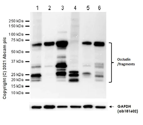 Western blot - Anti-Occludin antibody [EPR20992] - BSA and Azide free (AB224526)