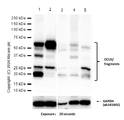 Western blot - Anti-Occludin antibody [EPR20992] - BSA and Azide free (AB224526)