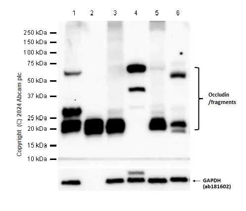 Western blot - Anti-Occludin antibody [EPR20992] - BSA and Azide free (AB224526)
