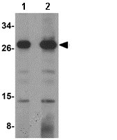 Western blot - Anti-OCIAD1 antibody (AB91574), expandable thumbnail