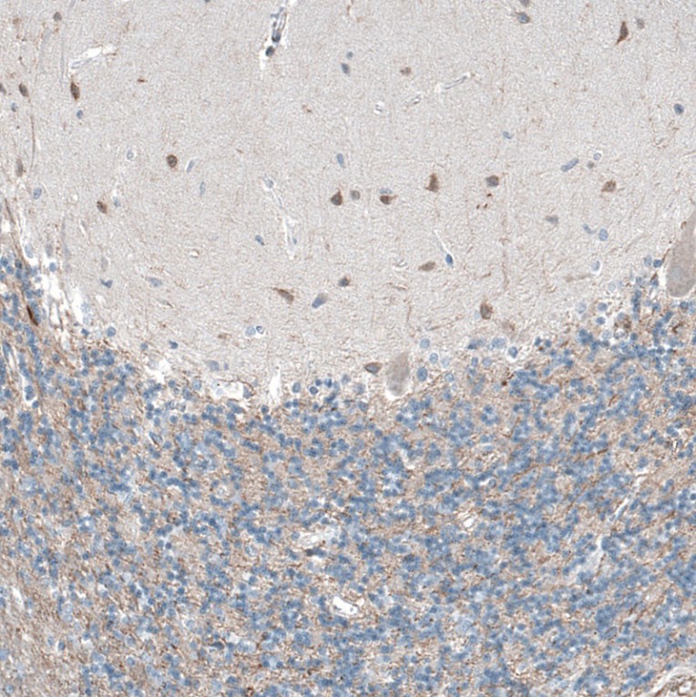 Immunohistochemistry (Formalin/PFA-fixed paraffin-embedded sections) - Anti-OCM antibody (AB150947)