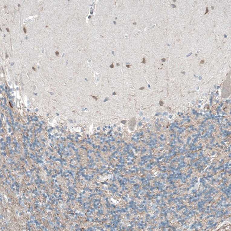 Immunohistochemistry (Formalin/PFA-fixed paraffin-embedded sections) - Anti-OCM antibody (AB150947)