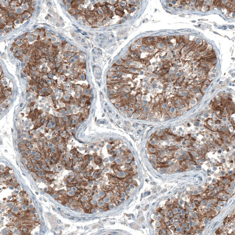 Immunohistochemistry (Formalin/PFA-fixed paraffin-embedded sections) - Anti-OCM antibody (AB150947)