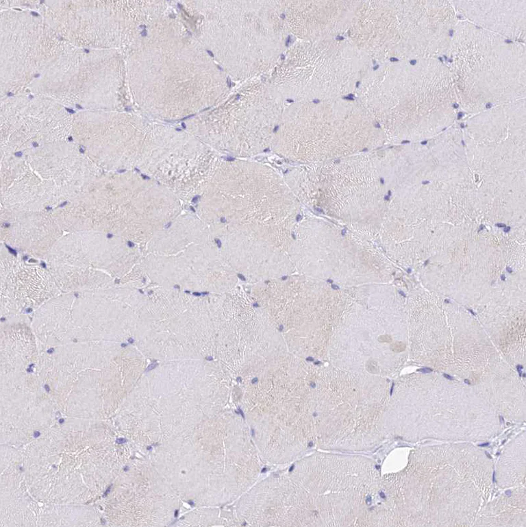 Immunohistochemistry (Formalin/PFA-fixed paraffin-embedded sections) - Anti-OCM antibody (AB150947)