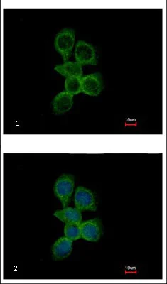 Immunocytochemistry/ Immunofluorescence - Anti-OCRL antibody (AB125917)