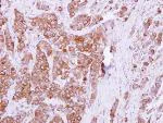 Immunohistochemistry (Formalin/PFA-fixed paraffin-embedded sections) - Anti-OCRL antibody (AB125917)
