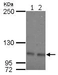 Western blot - Anti-OCRL antibody (AB125917)