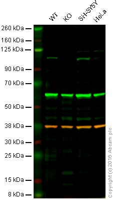 Western blot - Anti-OCRL antibody [EP10256] - BSA and Azide free (AB284833), expandable thumbnail