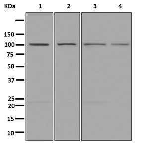 Western blot - Anti-OCRL antibody [EP10256] - BSA and Azide free (AB284833), expandable thumbnail