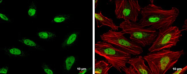 Immunocytochemistry/ Immunofluorescence - Anti-Oct-1 antibody (AB272867)
